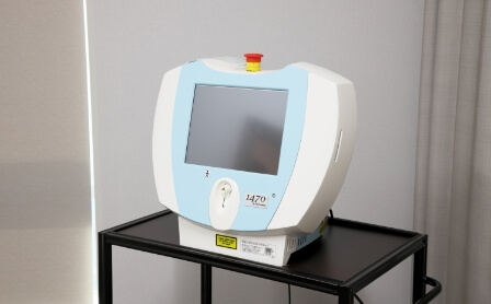 血管内レーザー